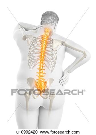 Stock Image - Obese man with back pain, computer illustration.. Fotosearch