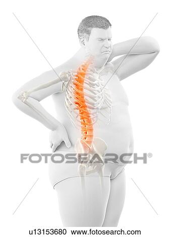 Stock Image - Obese man with back pain, computer illustration.. Fotosearch