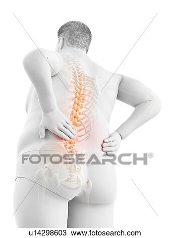 Stock Image - Obese man with back pain, computer illustration.. Fotosearch