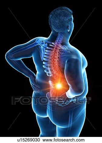 Stock Image - Obese man with back pain, computer illustration.. Fotosearch