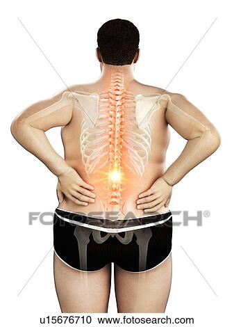 Stock Image - Obese man with back pain, computer illustration.. Fotosearch