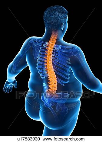 Stock Image - Obese man with back pain, computer illustration.. Fotosearch