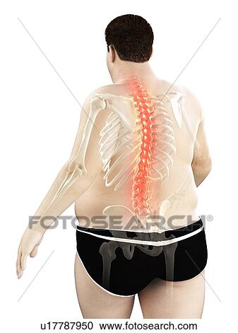 Obese man with back pain, computer illustration. View Large Photo Image Stock Image - Obese man with back pain, computer illustration.. Fotosearch
