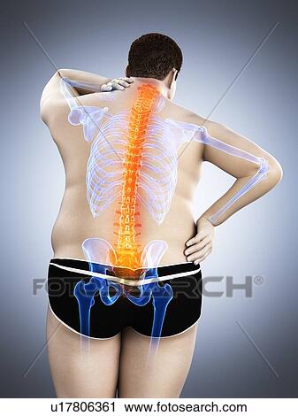 Stock Image - Obese man with back pain, computer illustration.. Fotosearch
