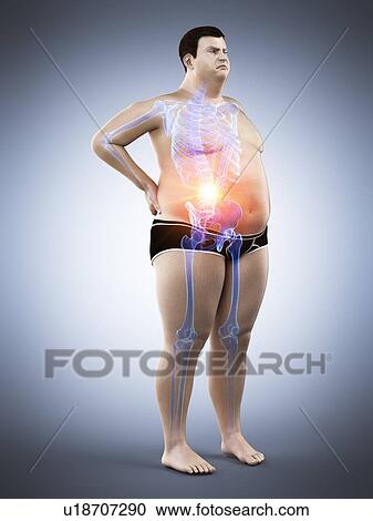 Stock Image - Obese man with back pain, computer illustration.. Fotosearch