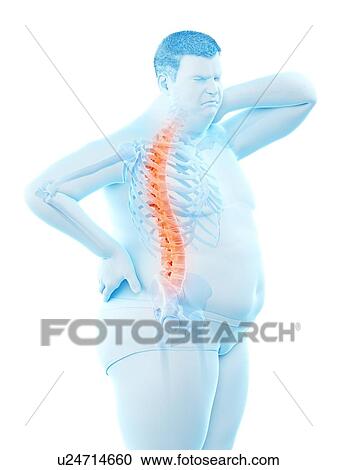 Stock Image - Obese man with back pain, computer illustration.. Fotosearch