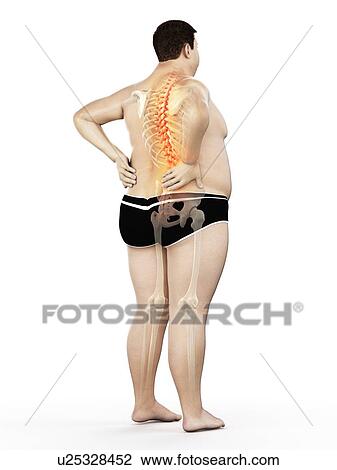 Stock Image - Obese man with back pain, computer illustration.. Fotosearch