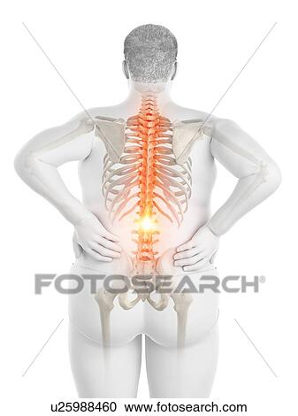 Stock Image - Obese man with back pain, computer illustration.. Fotosearch