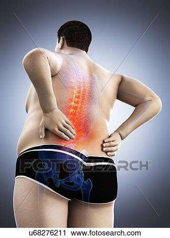 Stock Image - Obese man with back pain, computer illustration.. Fotosearch