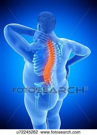 Stock Image - Obese man with back pain, computer illustration.. Fotosearch