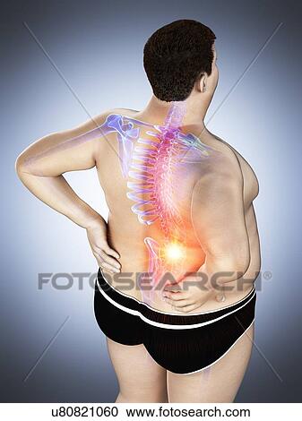 Stock Image - Obese man with back pain, computer illustration.. Fotosearch