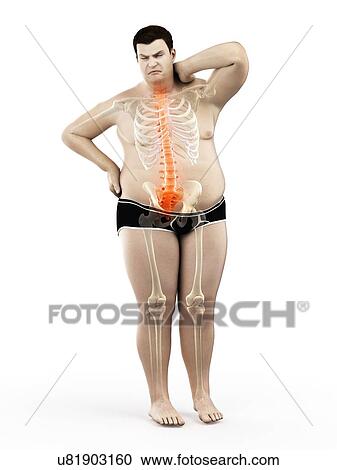 Stock Image - Obese man with back pain, computer illustration.. Fotosearch