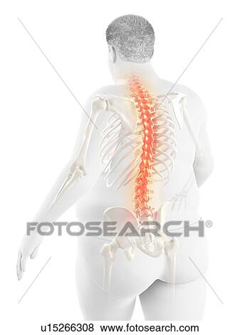 Stock Photo - Obese man with back pain, computer illustration.. Fotosearch