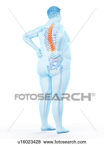 Stock Photo - Obese man with back pain, computer illustration.. Fotosearch