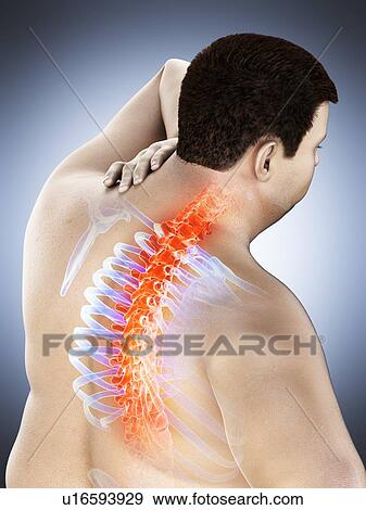 Stock Photo - Obese man with back pain, computer illustration.. Fotosearch