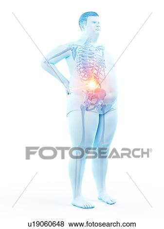 Stock Photo - Obese man with back pain, computer illustration.. Fotosearch