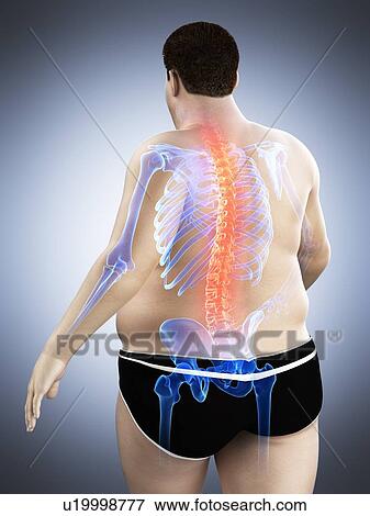 Stock Photo - Obese man with back pain, computer illustration.. Fotosearch