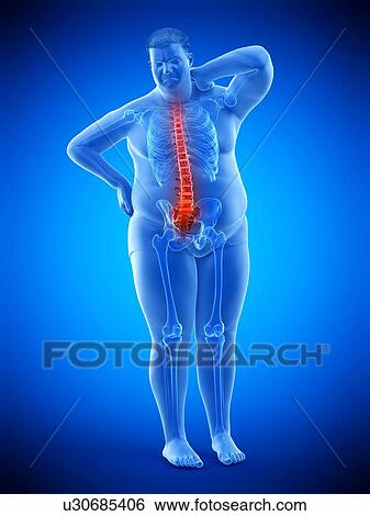 Stock Photograph - Obese man with back pain, computer illustration.. Fotosearch