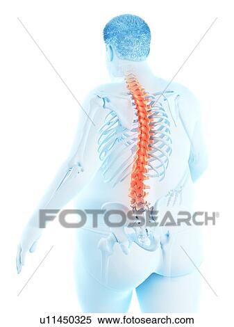 Stock Photography - Obese man with back pain, computer illustration.. Fotosearch