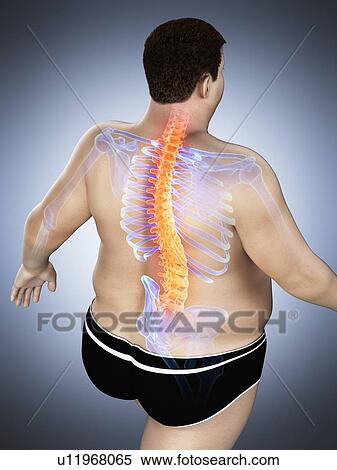 Stock Photography - Obese man with back pain, computer illustration.. Fotosearch
