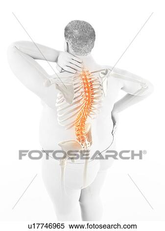 Stock Photography - Obese man with back pain, computer illustration.. Fotosearch