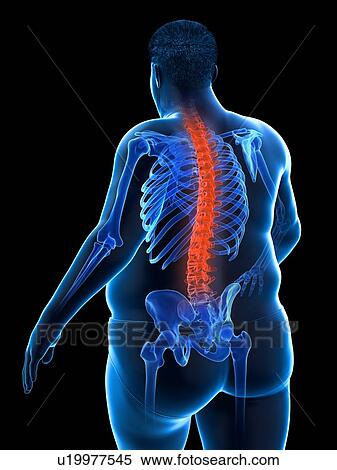 Stock Photography - Obese man with back pain, computer illustration.. Fotosearch