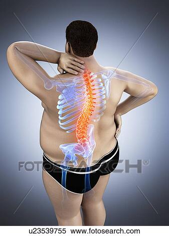 Stock Photography - Obese man with back pain, computer illustration.. Fotosearch