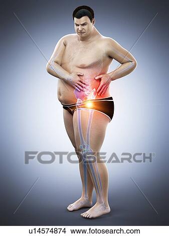 Picture - Obese man with hip pain, computer illustration.. Fotosearch