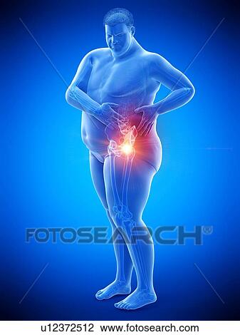 Stock Image - Obese man with hip pain, computer illustration.. Fotosearch