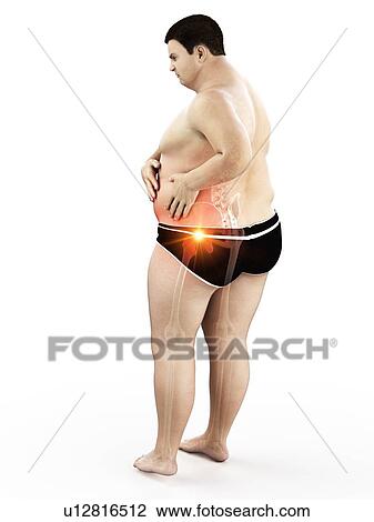 Stock Image - Obese man with hip pain, computer illustration.. Fotosearch
