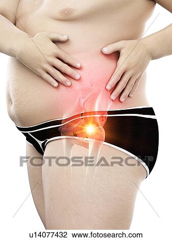 Stock Image - Obese man with hip pain, computer illustration.. Fotosearch