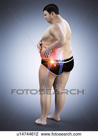 Stock Image - Obese man with hip pain, computer illustration.. Fotosearch