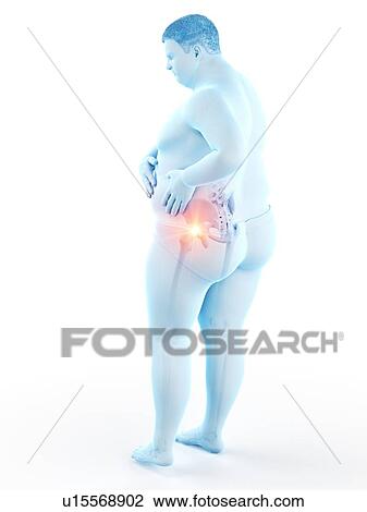 Stock Image - Obese man with hip pain, computer illustration.. Fotosearch