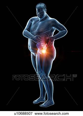 Obese man with hip pain, computer illustration. View Large Photo Image Stock Photo - Obese man with hip pain, computer illustration.. Fotosearch