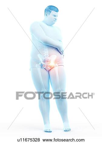 Stock Photo - Obese man with hip pain, computer illustration.. Fotosearch