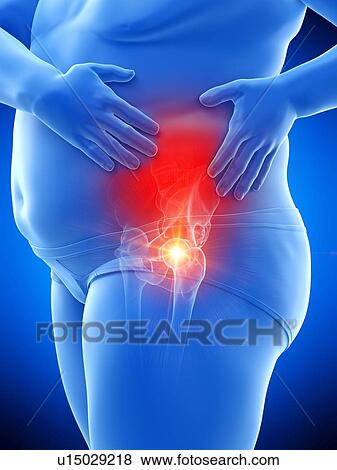 Obese man with hip pain, computer illustration. View Large Photo Image Stock Photo - Obese man with hip pain, computer illustration.. Fotosearch
