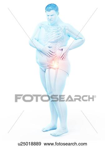 Stock Photo - Obese man with hip pain, computer illustration.. Fotosearch