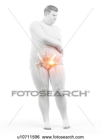 Stock Photograph - Obese man with hip pain, computer illustration.. Fotosearch