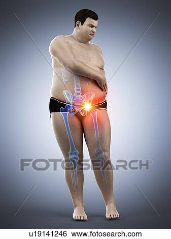 Stock Photograph - Obese man with hip pain, computer illustration.. Fotosearch