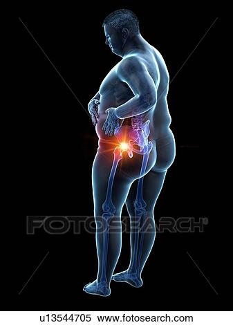 Stock Photography - Obese man with hip pain, computer illustration.. Fotosearch
