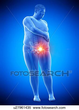 Obese man with hip pain, computer illustration. View Large Photo Image Stock Photography - Obese man with hip pain, computer illustration.. Fotosearch