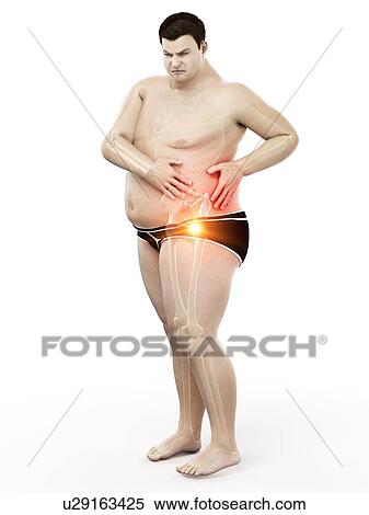 Stock Photography - Obese man with hip pain, computer illustration.. Fotosearch