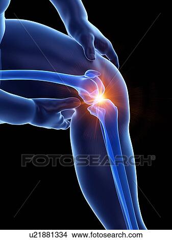 Picture - Obese man with knee pain, computer illustration.. Fotosearch