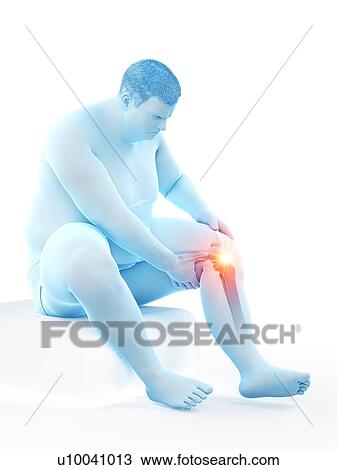 Obese man with knee pain, computer illustration. View Large Photo Image Stock Image - Obese man with knee pain, computer illustration.. Fotosearch