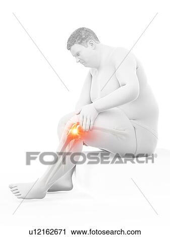 Obese man with knee pain, computer illustration. View Large Photo Image Stock Image - Obese man with knee pain, computer illustration.. Fotosearch