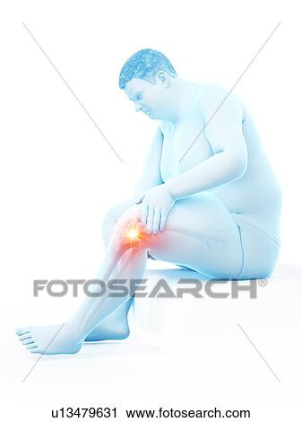 Obese man with knee pain, computer illustration. View Large Photo Image Stock Image - Obese man with knee pain, computer illustration.. Fotosearch