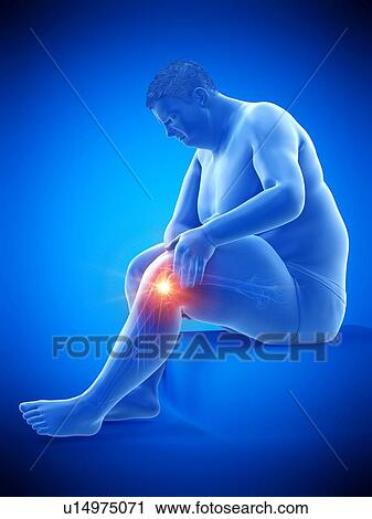 Obese man with knee pain, computer illustration. View Large Photo Image Stock Image - Obese man with knee pain, computer illustration.. Fotosearch