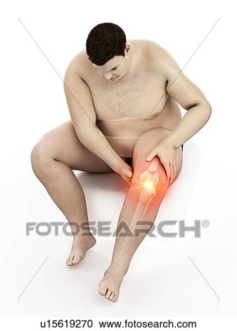 Stock Image - Obese man with knee pain, computer illustration.. Fotosearch