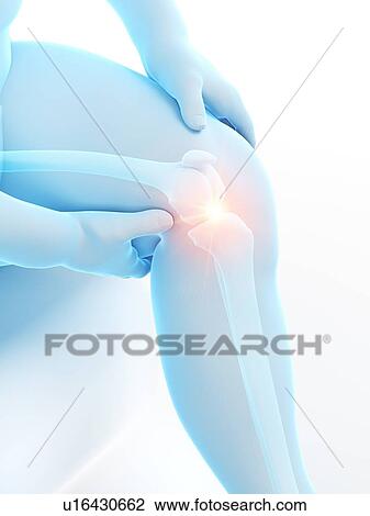 Stock Image - Obese man with knee pain, computer illustration.. Fotosearch