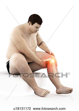 Stock Image - Obese man with knee pain, computer illustration.. Fotosearch